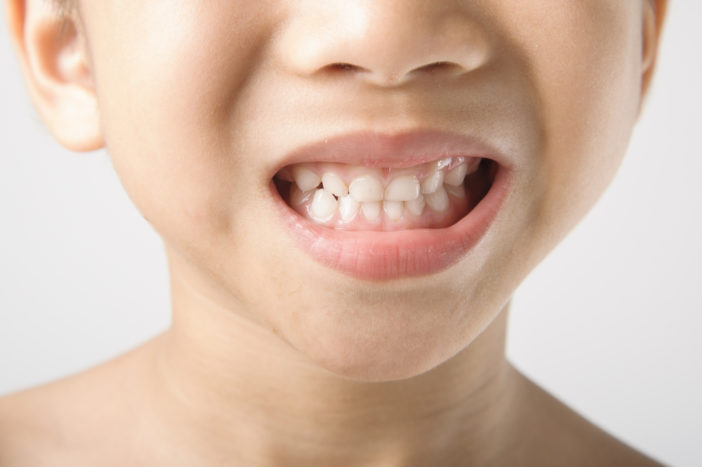 dantys ant vaikų dantų
