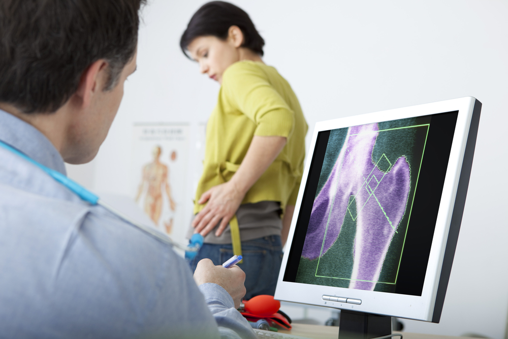 osteoporozės rizika