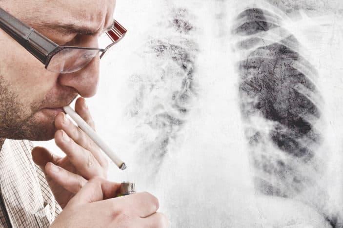 plaučių vėžio simptomai