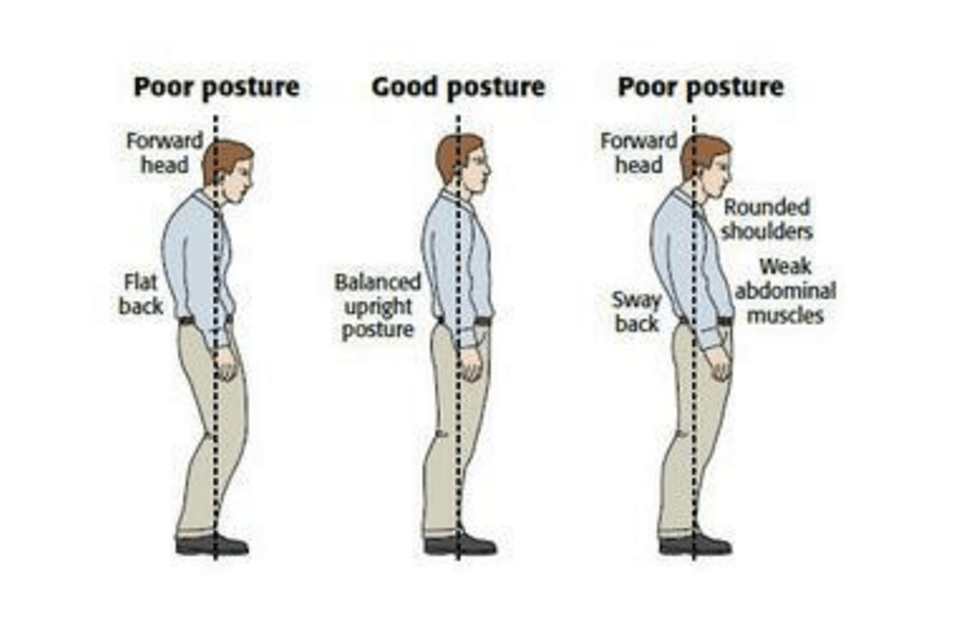 Vaizdo šaltinis: http://www.thephysiocompany.com/blog/stop-slouching-postural-dysfunction-symptoms-causes-and-treatment-of-bad-posture