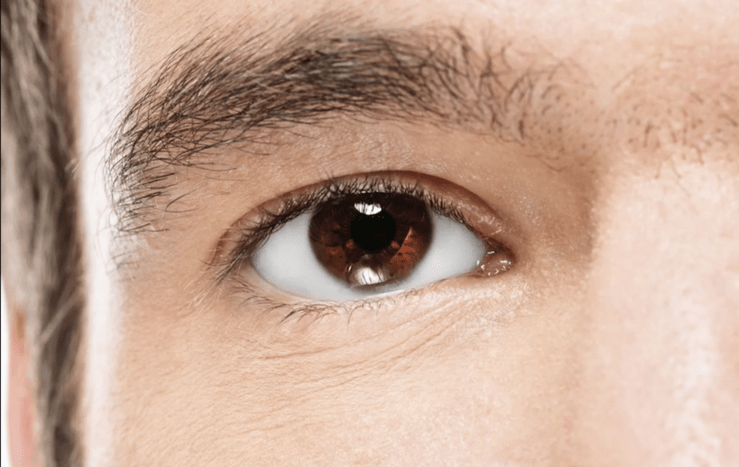 ūminio kampo uždarymo glaukoma