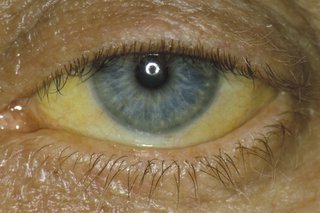 geltonos akys