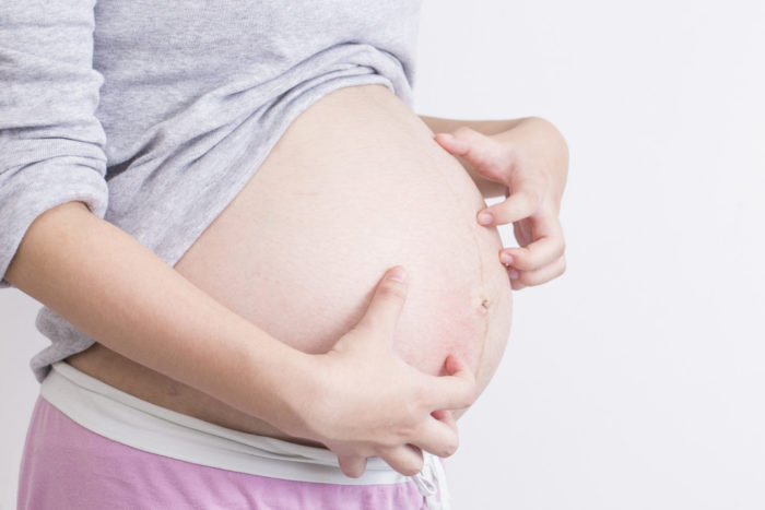 Niežėjęs folikulitas yra odos niežėjimo priežastis nėštumo metu