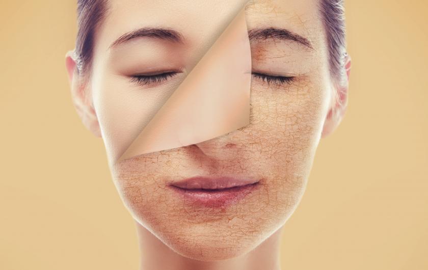 įveikti sausą veido odą