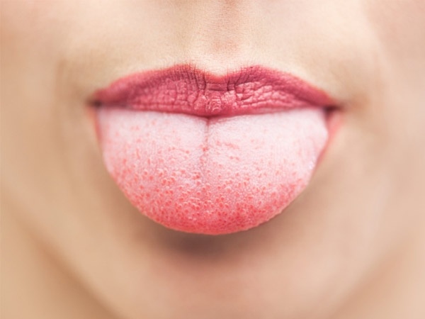 liežuvio spalva reiškia ligą